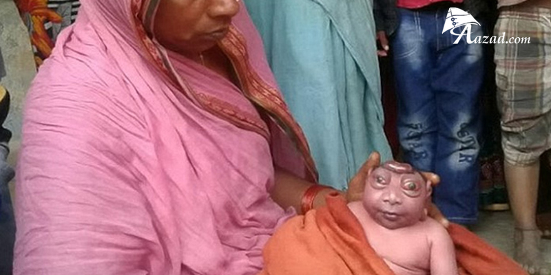 Alien Looking,frog face baby, Deformed faced child in India